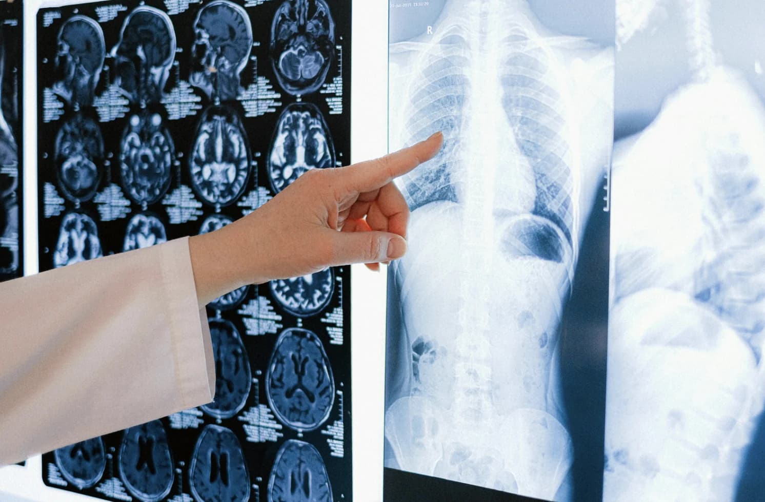 Interventional Radiology imaging service